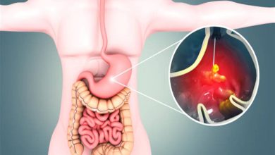 صورة 6 علامات خفية تكشف مرضا خطيرا في المعدة