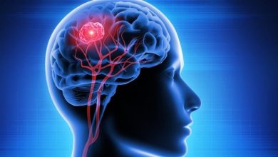 صورة الوقاية سر النجاة.. ما هو الورم الأرومي الدبقي؟