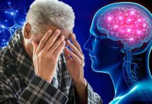 صورة علامات دماغية تنذر بألزهايمر.. لاتفوتك