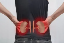 صورة 5 عادات يومية تهدد صحة الكلى.. احذرها