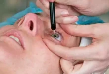 صورة 4 أطعمة تضعف شبكية العين.. ابتعد عنها فورا