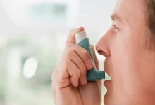 صورة ما أخطر أنواع الحساسية؟.. طبيبة تكشف