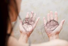 صورة لشعر صحي ولامع.. 10 أطعمة تحمي من التساقط