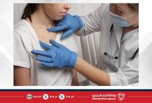 صورة تفشي الحصبة يتسع في الولايات المتحدة وتسجيل إصابات جديدة في كانساس