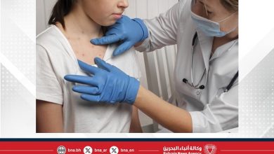 صورة تفشي الحصبة يتسع في الولايات المتحدة وتسجيل إصابات جديدة في كانساس