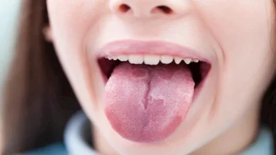 صورة لسانك يكشف أسرار صحتك.. طبيبة تحذر من علامات تنذر بأمراض خطيرة
