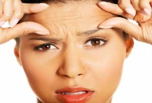 صورة للوقاية من التجاعيد المبكرة.. اتبع هذه الإجراءات