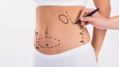 صورة احذر ..  اضرار شفط الدهون بكميات كبيرة من الجسم