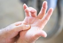 صورة لماذا نشعر بتنميل اليدين أثناء النوم؟ إليك الأسباب