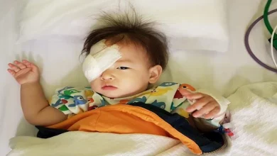 صورة احذر هذه الأعراض.. اكتشاف إصابة طفل بسرطان العين بعد ظهور علامة غريبة