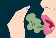 صورة أفضل الطرق للتخلص من رائحة الفم الكريهة