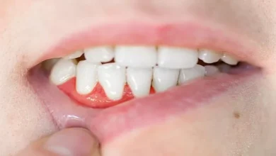 صورة خطر خفي.. كيف يؤثر التهاب اللثة على صحتك وقلبك؟