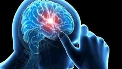 صورة جربها وانقذ حياتك.. حيلة بسيطة قد تكشف إصابتك بورم في المخ (فيديو)