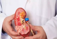 صورة دراسة تكشف قناع للوجه يكشف أمراض الكلى من بصمة التنفس