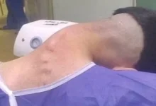 صورة شاب يتعرض للخطر بسبب الإدمان.. إليك ما حدث