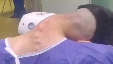 صورة شاب يتعرض للخطر بسبب الإدمان.. إليك ما حدث
