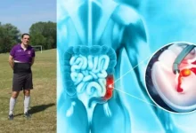 صورة رجل يعاني من سرطان قاتل يكشف عن 3 علامات خطيرة