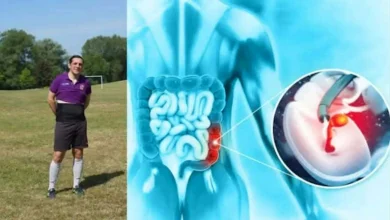 صورة رجل يعاني من سرطان قاتل يكشف عن 3 علامات خطيرة