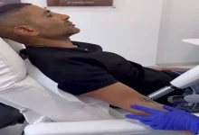 صورة فيديو لـ أحمد سعد لحظة إزالة التاتو من ذراعه..والفنان: “أحسن القرارات”