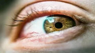 صورة احذر.. 3 أعراض خطيرة لـ جلطة العين وهذه طرق الوقاية