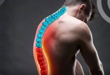صورة ظهرك في خطر.. كيف يُشوه العصر الرقمي عمودك الفقري؟  أخبار السعودية