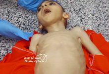 صورة استشهاد طفل بغزة بسبب الجوع (صور وفيديو)
