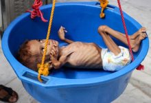 صورة المجاعة تستعد لغزو اليمن والأمم المتحدة تحذر