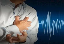 صورة الرجفان الأذيني.. اضطراب قلبي قد يسبب السكتة الدماغية