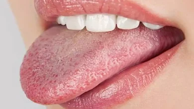 صورة احذر.. علامات على اللسان قد تكشف أمراضا خطيرة