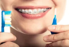 صورة الفرشاة الجافة أم المبللة.. أيهما أفضل لتنظيف الأسنان؟