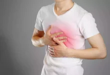 صورة علاج طبيعي.. أطعمة تساعد في التخلص من حرقة المعدة