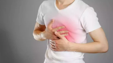 صورة علاج طبيعي.. أطعمة تساعد في التخلص من حرقة المعدة