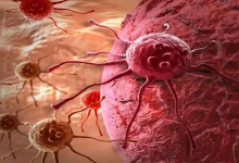 صورة 5 أطعمة ومشروبات شائعة قد تسبب السرطان.. طبيب يحذر