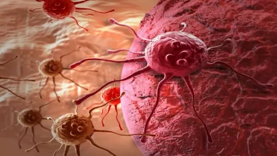 صورة 5 أطعمة ومشروبات شائعة قد تسبب السرطان.. طبيب يحذر