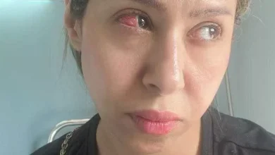 صورة بسبب خطأ طبي.. إيناس عز الدين تخضع لعملية عاجلة في العين