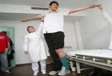 صورة منها الطول.. عوامل تؤثر على نمو الإنسان