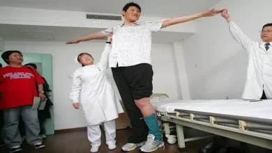 صورة منها الطول.. عوامل تؤثر على نمو الإنسان