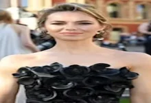 صورة أصيبت به الممثلة البريطانية كارا توينتون.. أعراض تدل على حملك لجين خطي