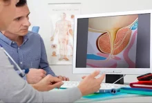 صورة عانى من هذه الأعراض.. وفاة رجل بعد أسبوع من ظهور علامات خطيرة