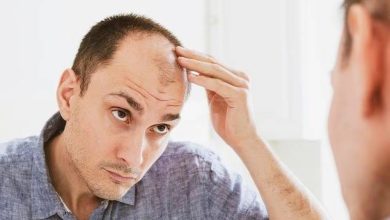 صورة وداعاً للصلع.. اكتشاف علاج لتساقط الشعر باستخدام الخلايا الجذعية  أخبار السعودية