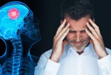 صورة علاج مبتكر يحقق السيطرة على سرطان الرئة المتقدم