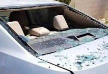 صورة | مستشفى الزرقاء يكشف الحالة الصحية لطفلين شقيقين أصيبا إثر سقوط مسيّرة