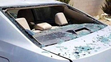 صورة | مستشفى الزرقاء يكشف الحالة الصحية لطفلين شقيقين أصيبا إثر سقوط مسيّرة