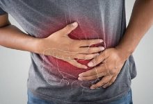 صورة برامج الرياضة المنتظمة تقلل من خطر الوفاة بسرطان القولون