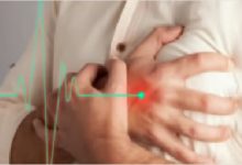 صورة إيقاف الاسبرين فجأةً بعد الجلطة يضاعف خطر الإصابة بها مرةً أخرى