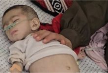 صورة استشهاد طفلة نتيجة التجويع وعشرات الشهداء خلال البحث عن المساعدات في غزة