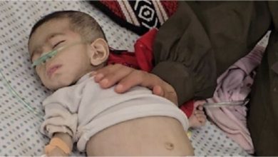 صورة استشهاد طفلة نتيجة التجويع وعشرات الشهداء خلال البحث عن المساعدات في غزة