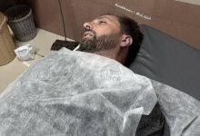 صورة استشهاد شاب في سلواد في هجوم للمستعمرين طال أيضا رمون وأبو فلاح