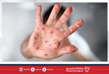 صورة تايلاند تسجل 40 إصابة بجدري القرود منذ مطلع 2025