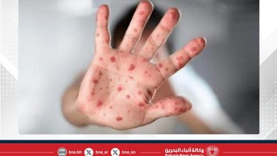 صورة تايلاند تسجل 40 إصابة بجدري القرود منذ مطلع 2025